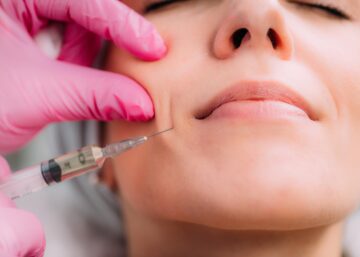 Juvederm Injections